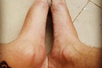 Feet And Ankle Swelling After Leg Tattoo Midlifemate in size 1029 X 1029